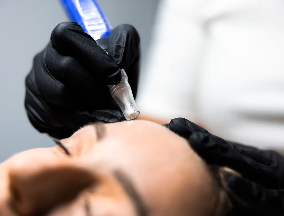 Rejuran skin booster treatment